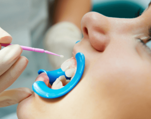 4 Preventive Dentistry Strategies Parents Should Use At Home