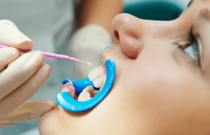 4 Preventive Dentistry Strategies Parents Should Use At Home