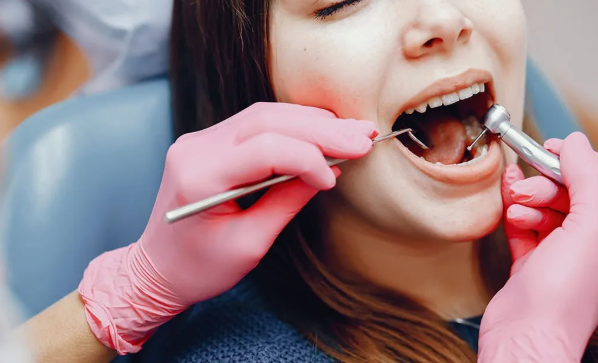 7 Everyday Habits That Quietly Damage Teeth
